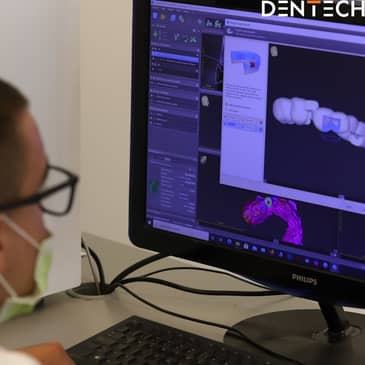 Slider image (8) Dentech Dental Centar